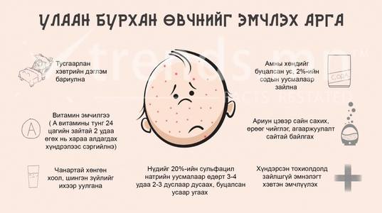 Улаанбурхан өвчнийг эмчлэх аргаас 