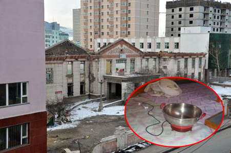 Түлэгдэлтийн улмаас жилд 30-40 хүүхэд нас барж байна