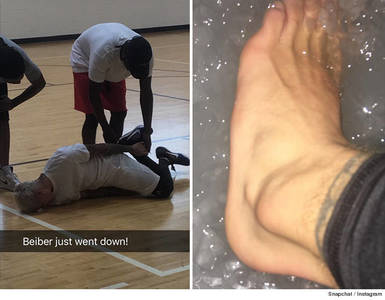 Бибер хөлөө гэмтжээ