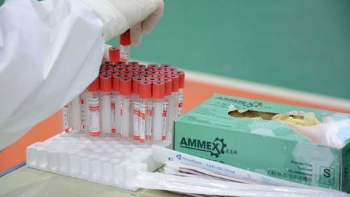 Коронавируст халдварыг тандах, илрүүлэх шинжилгээнд 71950 иргэнийг хамруулжээ