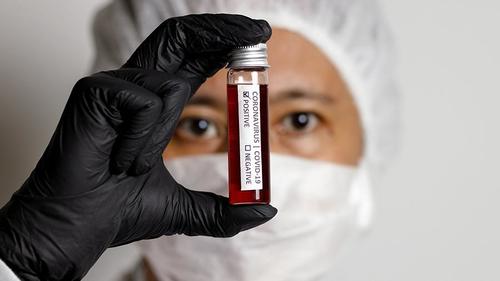 ДЭМБ COVID-19-ийн үүслийн талаарх үнэнд ойр таамаглалыг нэрлэв