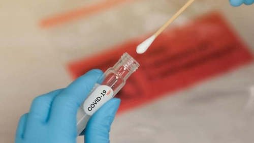 Манай улсад ирсэн Энэтхэгийн 19 иргэнээс ковид илэрлээ