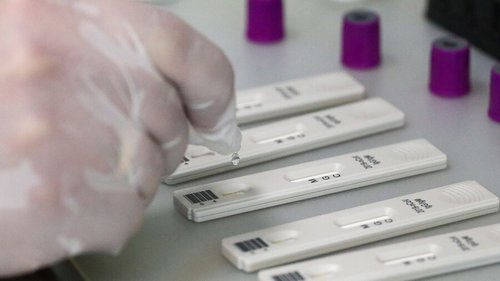 ОХУ-д вакцин тариулсны дараах эсрэг биетийг илрүүлэх тест бүртгэжээ