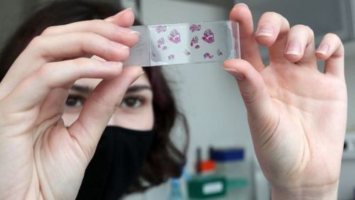 COVID-19 тусаад эдгэрсэн хүнд насан туршид нь дархлаа үүсэж магадгүй