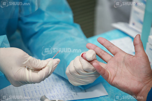 Сүрьеэгийн өвчлөл дунд сургуулиудад голомтлон гардаг болжээ