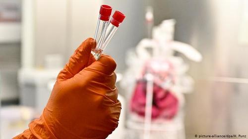 АНУ-ын тагнуул коронавирусийн үүслийг тогтоож чадсангүй