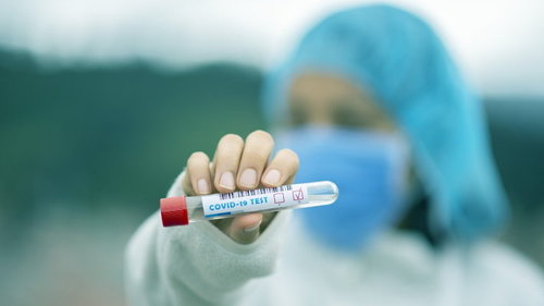 Норвегийн эрдэмтэн коронавирусийг улирлын томуутай адилтгажээ