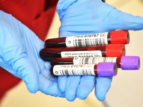 COVID-19-д өртөх эрсдэлтэй цусны бүлгүүдийг нэрлэжээ