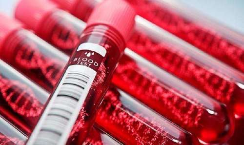 Түүхэнд анх удаа хиймэл цусыг хүн дээр туршиж байна