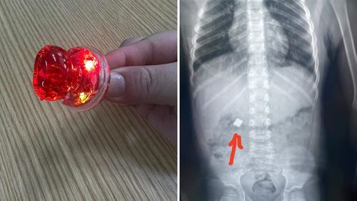 ЭХЭМҮТ: Товчин зайтай чихэрнээс болж хүүхэд эрүүл мэндээрээ хохирох эрсдэл их байна