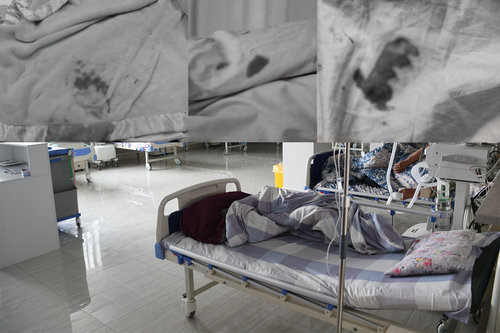 Улсын эмнэлгүүд хөнжил, гудсаа ариутгадаг уу