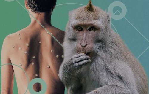 Японд сармагчны цэцэг өвчнөөс үүдэлтэй нас баралт анх удаа бүртгэгджээ